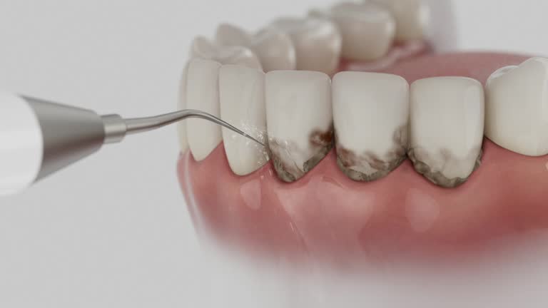 Reliable Teeth Cleaning And Checkup contractor in Lawrence County County, MS by Dentist Open Now